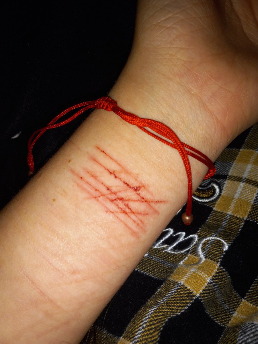 LSER66722307's tweet photo. Relapsed <3
TW//SH 
.
.
.
.
.
.
.
.
.
.
barcodetwt styro redbreadtwt 198twt sh twt ouchietwt catscratchestwt https://t.co/icIIAeUFGw