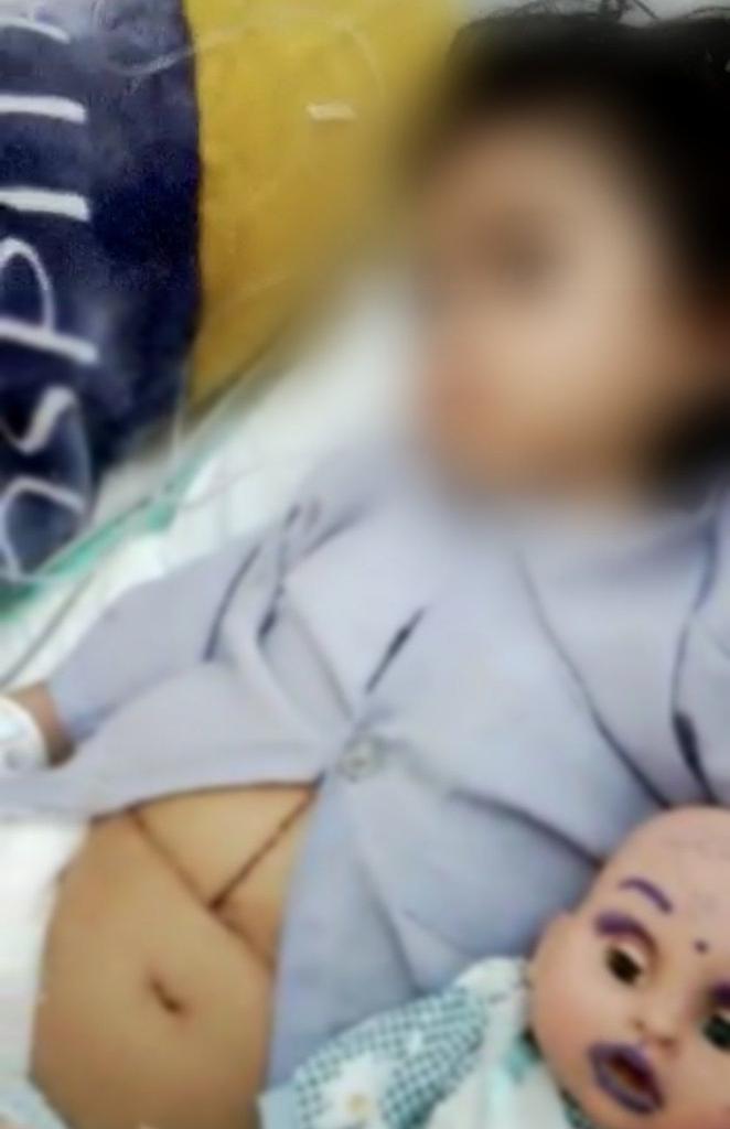 دختر ۳ ساله که چهار ماه پیش پیوند کبد انجام داده یک ماه است که مجرای کبدی‌اش تنگ شده و حتما باید بالن بزند. پیوند را هم از کبد مادر گرفتند. پدرش هم طحالش بزرگ شده و زده به کلیه‌هاش. هزینه عمل این دختر ۲۴ میلیون تومان می‌باشد.

کارت:
5041721111902848

#ريتوييت_لطفا