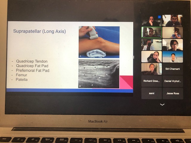 Loved learning about knee anatomy, effusions, ultrasound-assisted LPs, and VExUS at our interdisciplinary POCUS conference! Awesome speakers from all parts of medicine 
#pocus #echofirst  #vexus   #meded