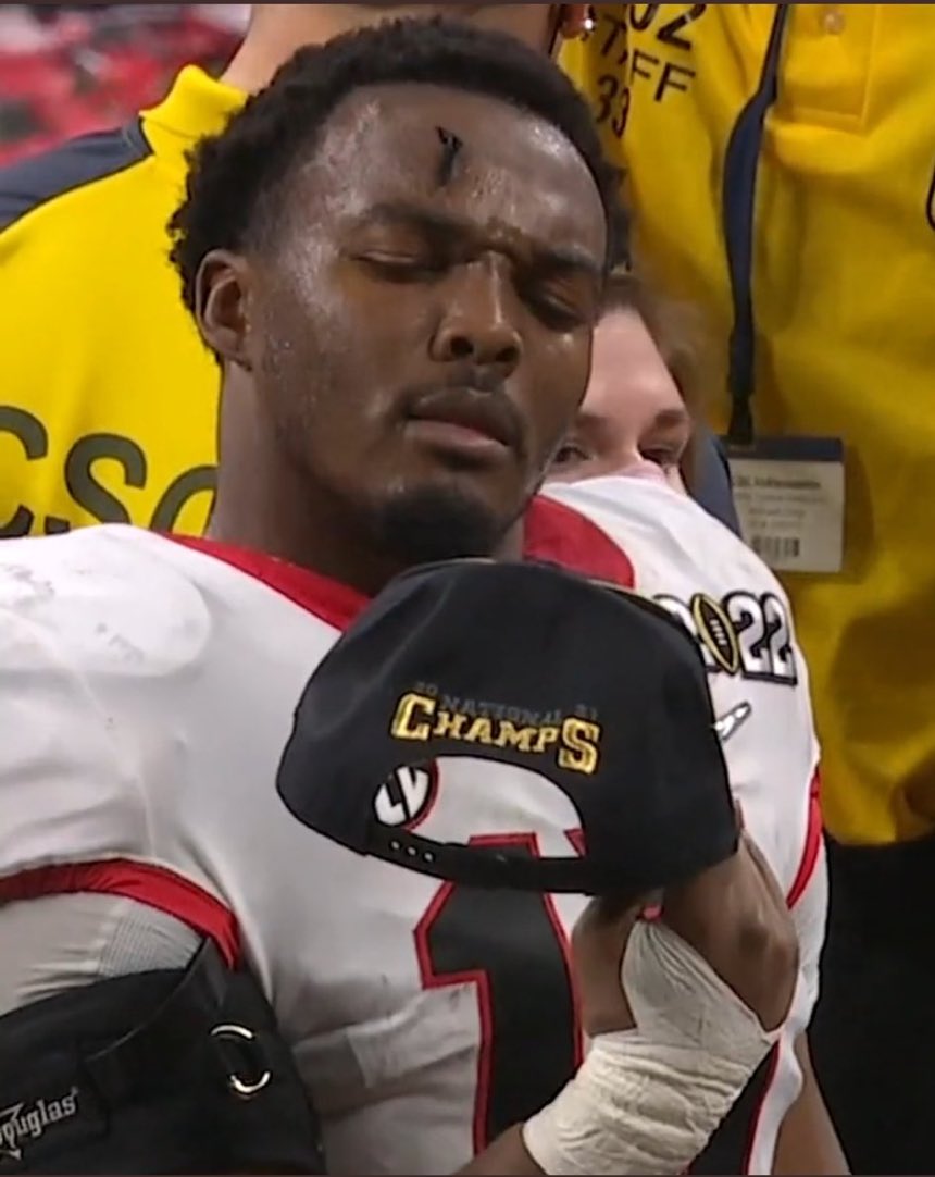 Caption This