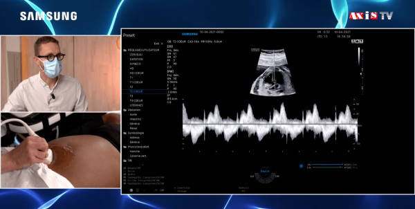 RevueVision's tweet photo. Cœur fœtal - Live scan sur patiente https://t.co/LWOdcl2Q8M https://t.co/BsgRNd4mm1