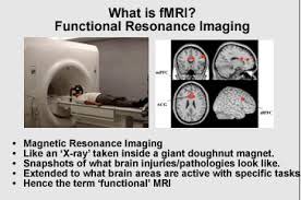 Oumkoulthoumlaa's tweet photo. #fMRI in #neuromarketing is the best method to predict consumers behaviours including conscious or unconscious emotions or thoughts. It measures the small changes in blood flow that occur with brain activity. @lets_NEUROmkt #MKTINGNEURO #NMKTRCH https://t.co/HjP1KVbRqA
