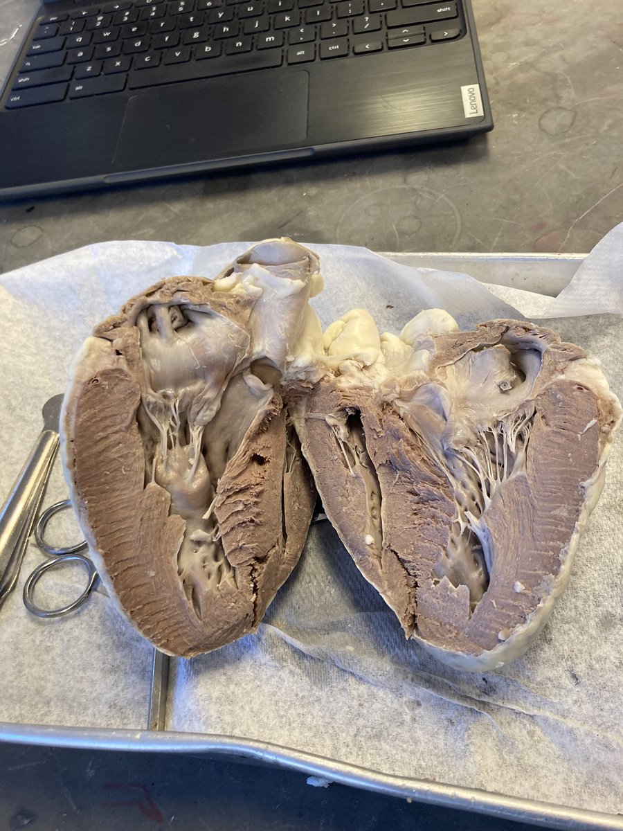 SciencebyDoyle's tweet photo. This is what a classroom looked like when medical terminology students create clay hearts and then dissect sheep hearts. #stem #education #fun @young_evolve @MSD_iSTEM https://t.co/ChTsCfmcQG