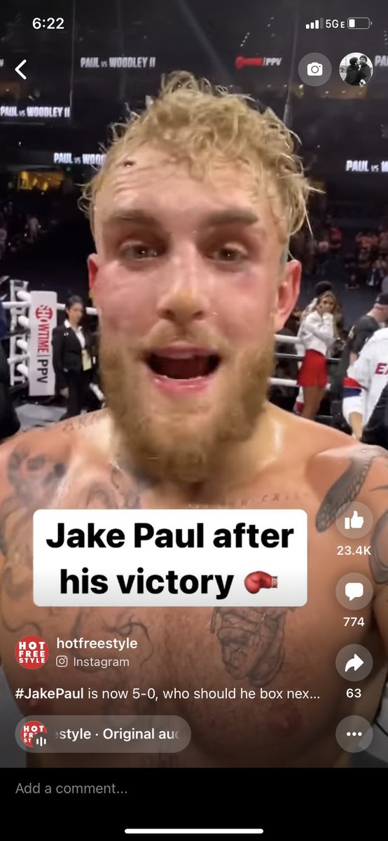 Joshua33825089's tweet photo. @jakepaul Yo Jake, did you have a gash on your head from the last fight? It looked fucking huge yet no blood? https://t.co/Z8gEPOcuDT