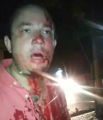 LBrytani's tweet photo. Quiere fundar su partido político, ya vió que siendo político puede atropellar y matar gente y nadie le hace nada. https://t.co/f4XBXPp0Fq