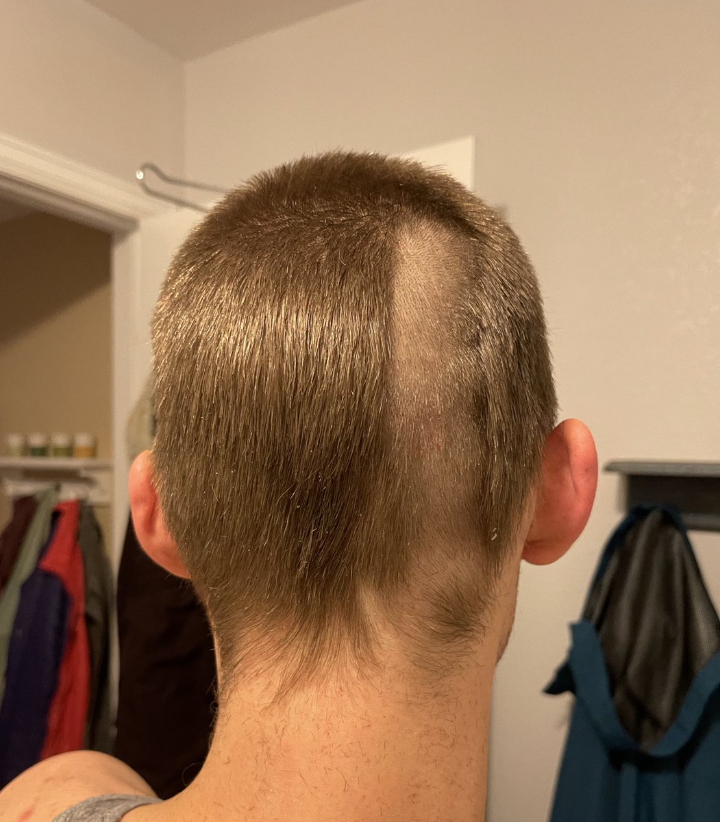 My fuckin guard broke on my clippers when I was shaving the back of my head YO
I have to take it all down now 🥲