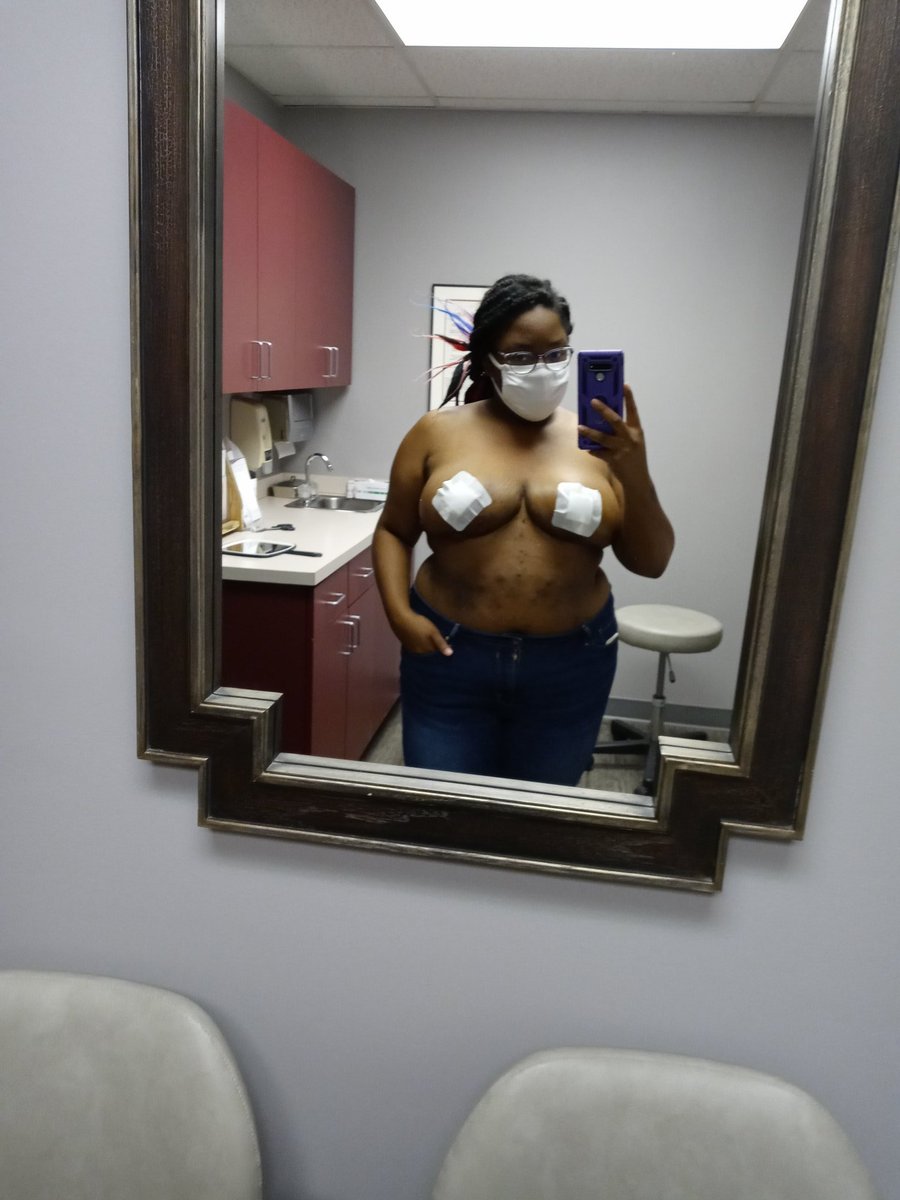 ItsMissFashion's tweet photo. First appointment vs most recent
(Scars on my stomach are from my skin condition) and also some before.... I know yall wanted to see those nips but im a modest lady 🤣🤣
#breastreduction #BreastReductionIsNotCosmetic https://t.co/QmXRZYKxuM