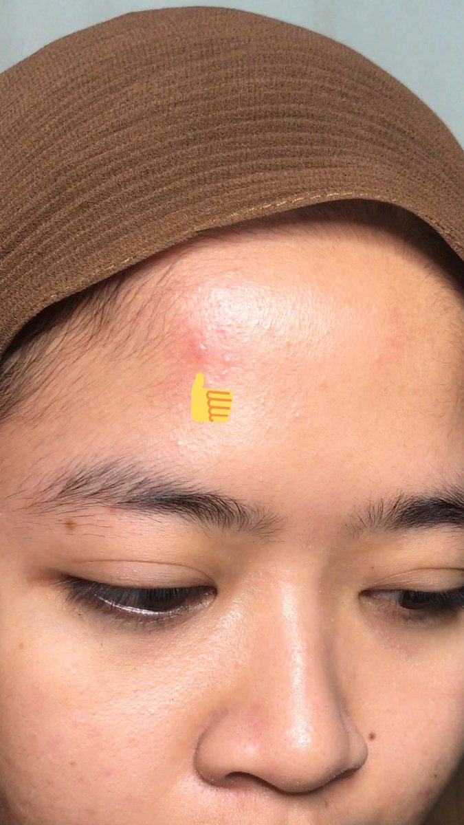 kforkinsley's tweet photo. Mumpung ada beberapa dark spot & redness diwajahku, aku mau cobain nih rutin tiap harii pake moisturizernya. Hmm mari kita liat nanti yaah, setelah 2-3 minggu pemakaian.
YUHUUU GASABAR MAU LIAT HASILNYA 🥺🥺
#BasictobeTrue @avoskinbeauty
#racunskincare #racunskincaremakeup https://t.co/DRZCgSvPJm