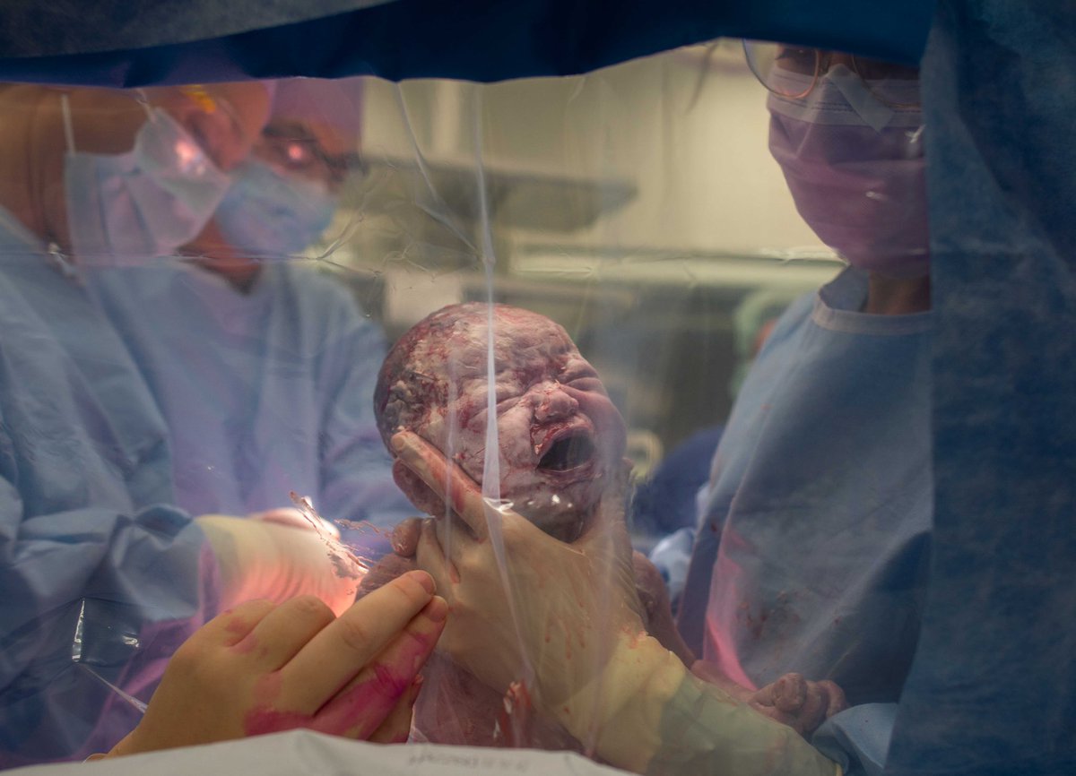 Margreet_N's tweet photo. Birth is amazing, no matter how it happens!
I really love capturing a woman’s strength, the care of a father and the miracle of birth. https://t.co/OXXB2JmRfa