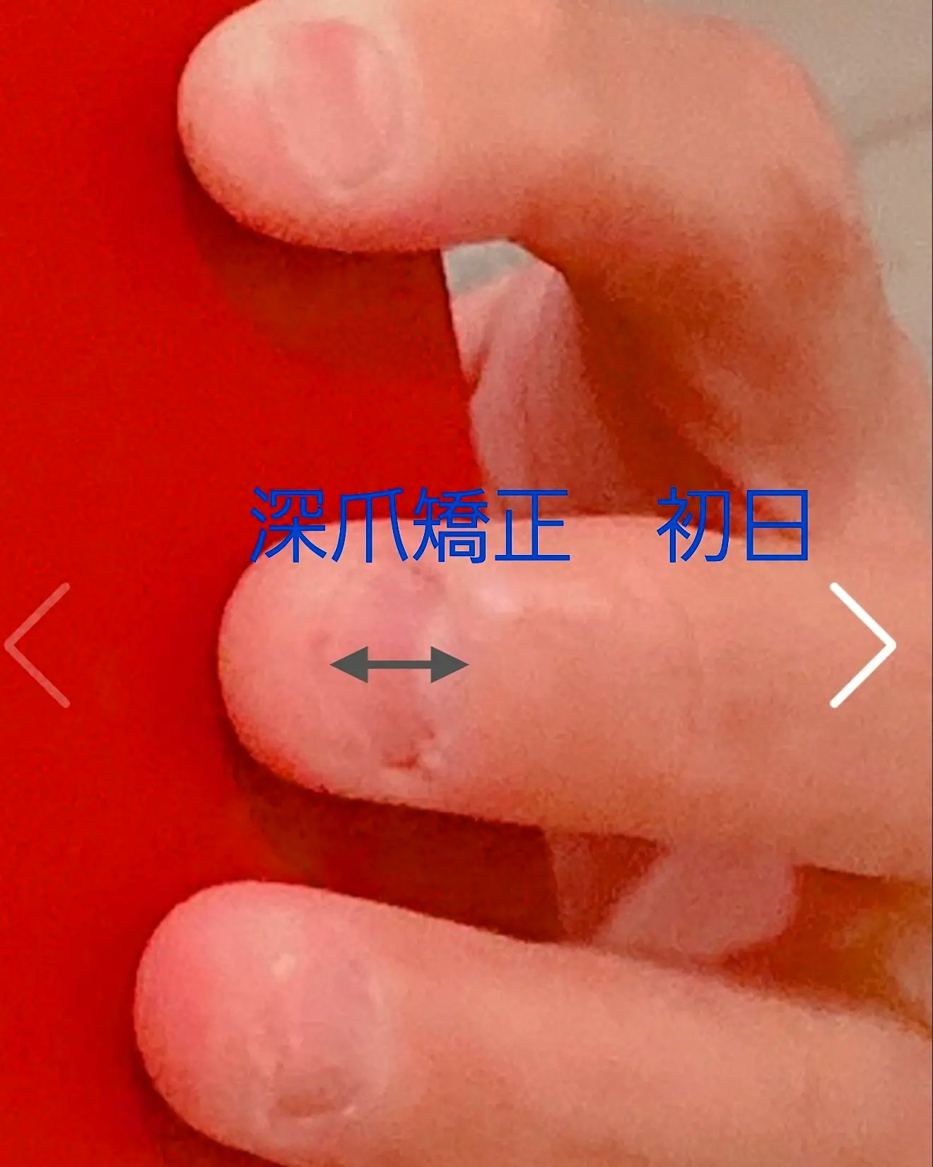 男性専用ハンドケア マッサージサロン ダンディネイル Fukuoka Dandynail Twitter
