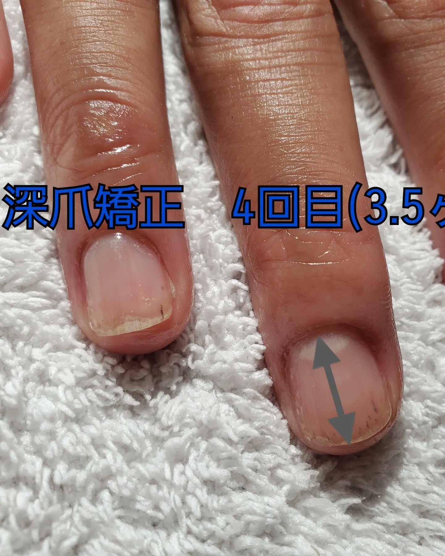 男性専用ハンドケア マッサージサロン ダンディネイル Fukuoka Dandynail Twitter