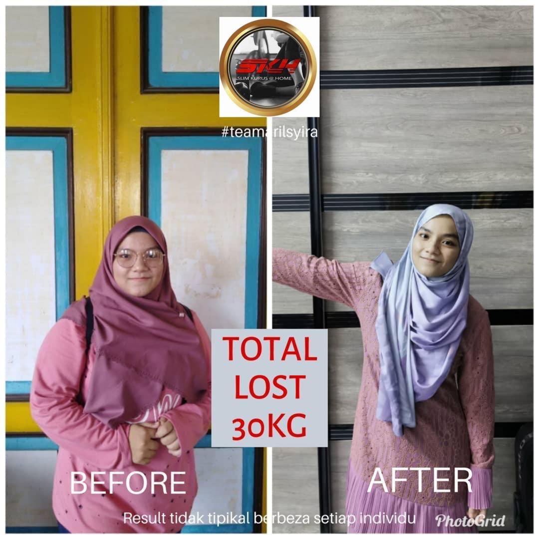 9 slot lagi!

Siapa nk turunkn berat, kecilkn peha, hilangkn double chin &amp; tukar saiz baju XXL➡️M/S Bulan Feb ni?  

PRIVACY ONLINE DIET, list makan &amp; list workout disediakan.

Best gaiss nnt pakai baju rasa longgar, nak ootd pon cantik je😍

Tekan link kat bio saya!

RT