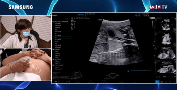 RevueVision's tweet photo. Examen de l'œsophage - Live scan sur patiente https://t.co/JZNF1iOxn6 https://t.co/PnXZNZcpBh