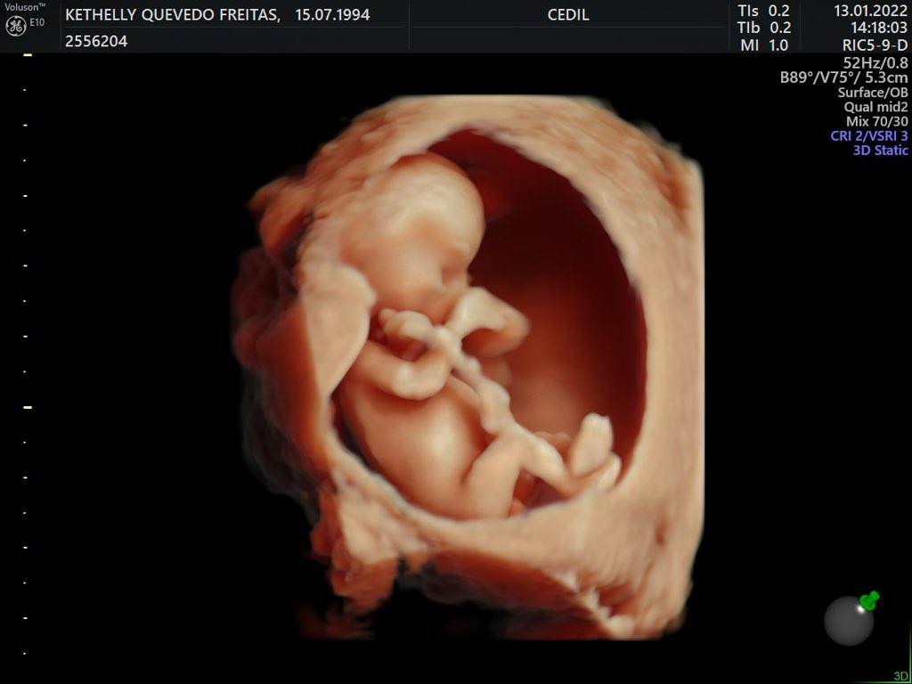 kethellyd's tweet image. Nossa Marjorie 💖 @PlSamu_el