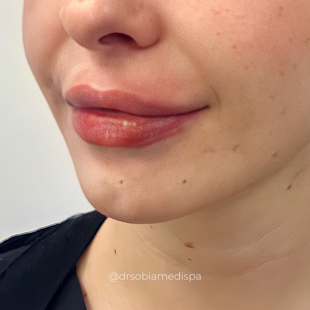 Dr Sobia Medispa tweet media