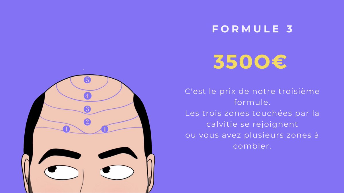 centreRacine2's tweet photo. 3 formules de greffe = 3 prix
#greffe #greffecheveux #implantcapillaire https://t.co/cS519hec40