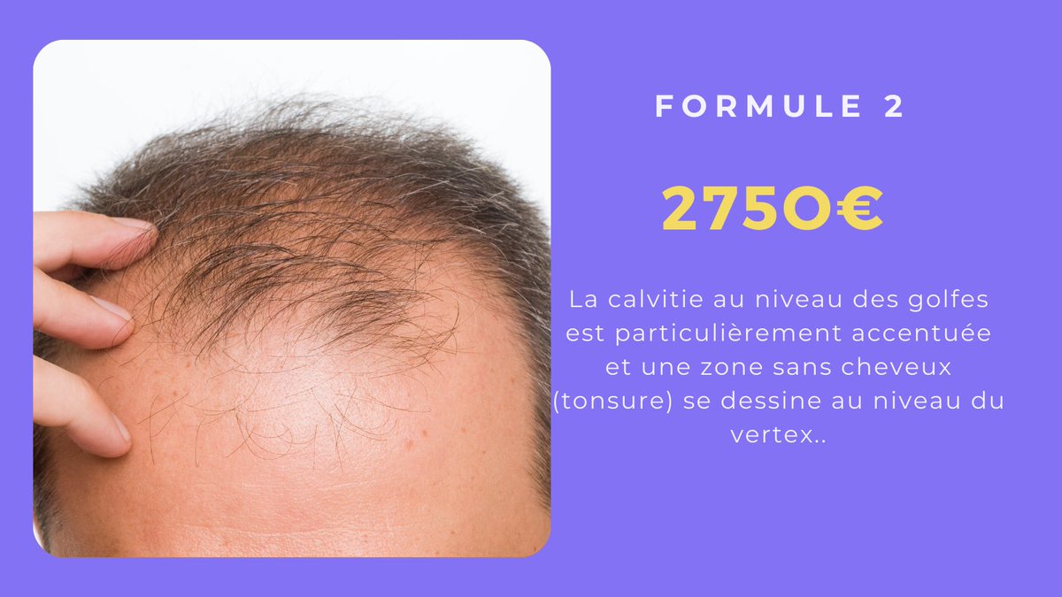 centreRacine2's tweet photo. 3 formules de greffe = 3 prix
#greffe #greffecheveux #implantcapillaire https://t.co/cS519hec40