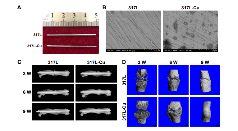 RBResearchTeam's tweet image. Nano-copper-bearing stainless steel (317L-Cu SS) increase Cu2+ content which promotes osteogenesis in the callus and quickens the callus growth process and formation of bone to yield better fracture healing. (Wang et al., 2017)
Source: doi.org/10.2147/IJN.S1…
Shared by: Khairun