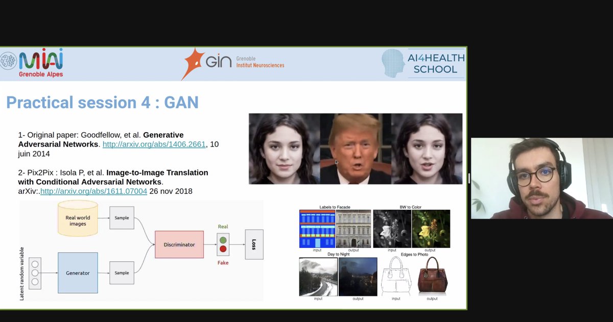 nifm_gin's tweet photo. During today Practical Session, @Cackowski_S presented the Generative Adversarial Networks and we then used this architecture to generate the effect of Gadolinium contrast agent on MRI T1 images without any agent. #MRI #GAN #DeepLearning #AI4Health @HealthDataHub @MIAI_UGA https://t.co/FYXxgsqS0M