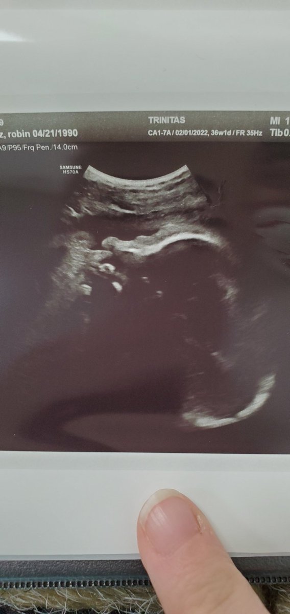 11 days left til we meet our blessing