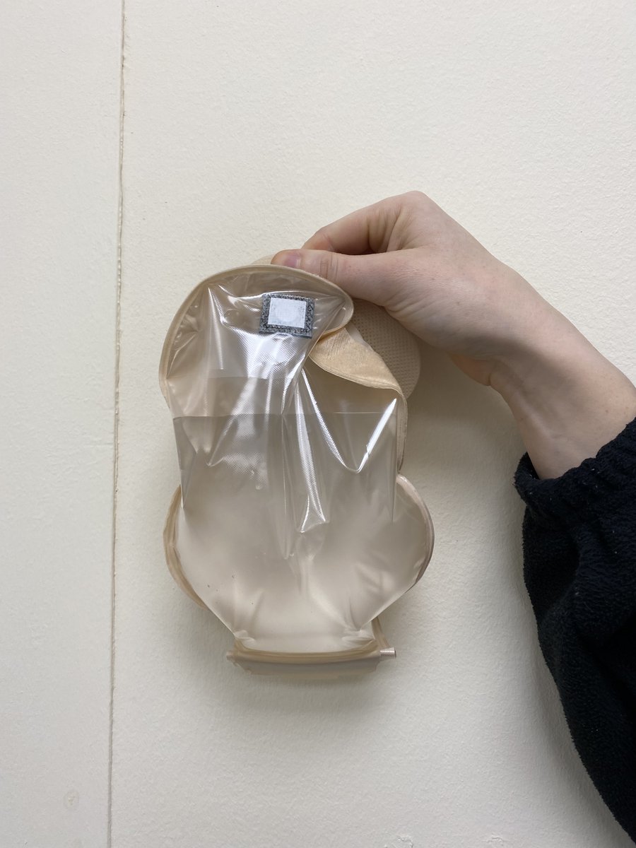 SashTherapies's tweet photo. The Surgical Dietitians are giving a high output stoma CPD to the medical team. It is important that Dietitians know the volume of a stoma bag to know if the ouptut is high. How much do you think is in these stoma bags?
#CPD #HighOutputStoma #GuessTheVolume https://t.co/bsAd0bxOXI