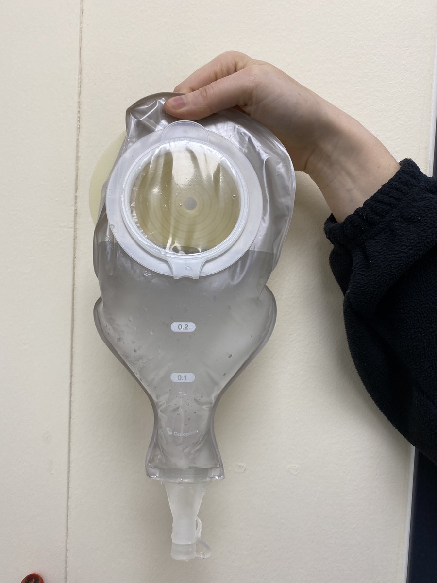 The Surgical Dietitians are giving a high output stoma CPD to the medical team. It is important that Dietitians know the volume of a stoma bag to know if the ouptut is high. How much do you think is in these stoma bags?
#CPD #HighOutputStoma #GuessTheVolume