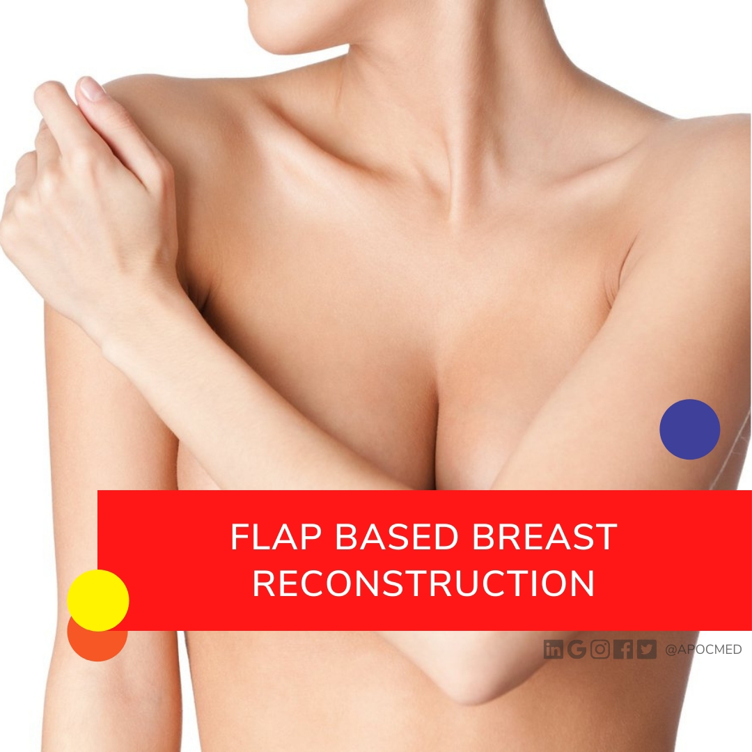 Flap reconstruction uses a woman’s own tissue (including skin, fat, and occasionally muscle) to reconstruct the breast.

-Team APOC-
#BreastAugmentation #breastreduction #breastreconstruction #flapreconstruction #implantreconstruction #breastcancer #cancersurvivor #plasticsurgery