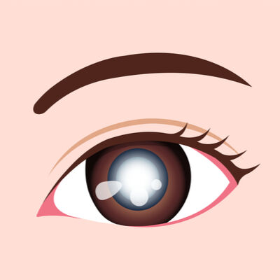 CaptContributor's tweet photo. Cataracts affect more than just your eyesight. They can also increase your risk of developing dementia. Your benefit accounts can help pay for cataract surgery. https://t.co/Zk0HLbAM15 #cataracts #eyehealth #FSA #HSA #LPFSA https://t.co/ozbptVDtXp