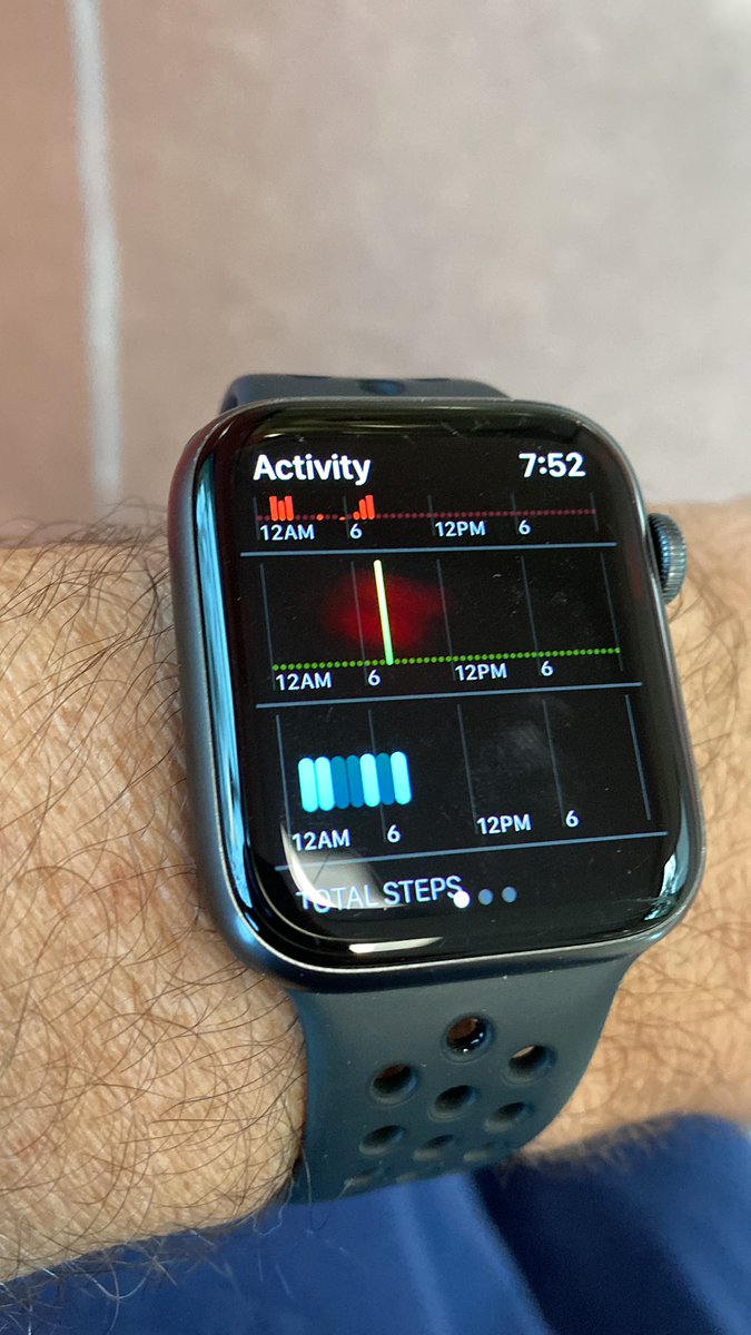 When you are a full professor taking in-house intern call, even a typical call night feels rough…Better than my last one, though.