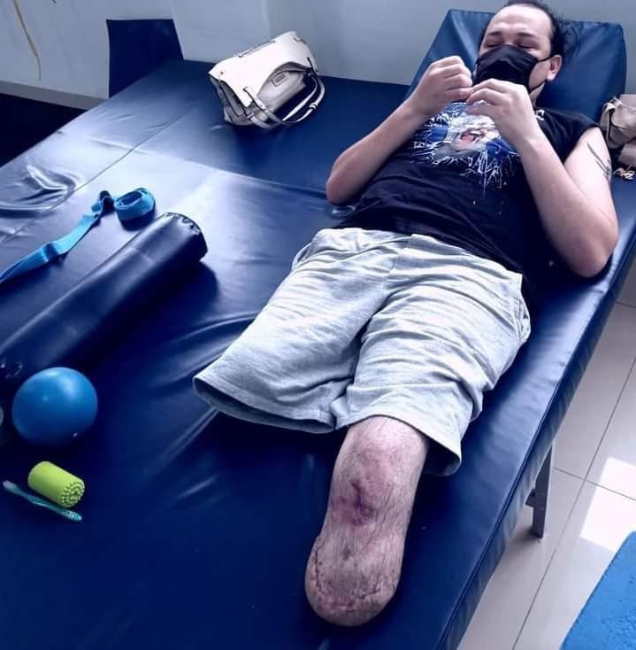 machine_cast's tweet photo. Esse é nosso amigo e ouvinte Leandro Silva, que sofreu um acidente perdendo as duas pernas.
Vamos ajudar a viabilizar tratamento e próteses?

Link da Vakinha - https://t.co/E5rv7wjliv

PIX - tel.11995801160

Perfil do Insta - https://t.co/M6hrZRHW6W

AJUDAR É UM ATO DE AMOR! https://t.co/AJY0lY2yPB