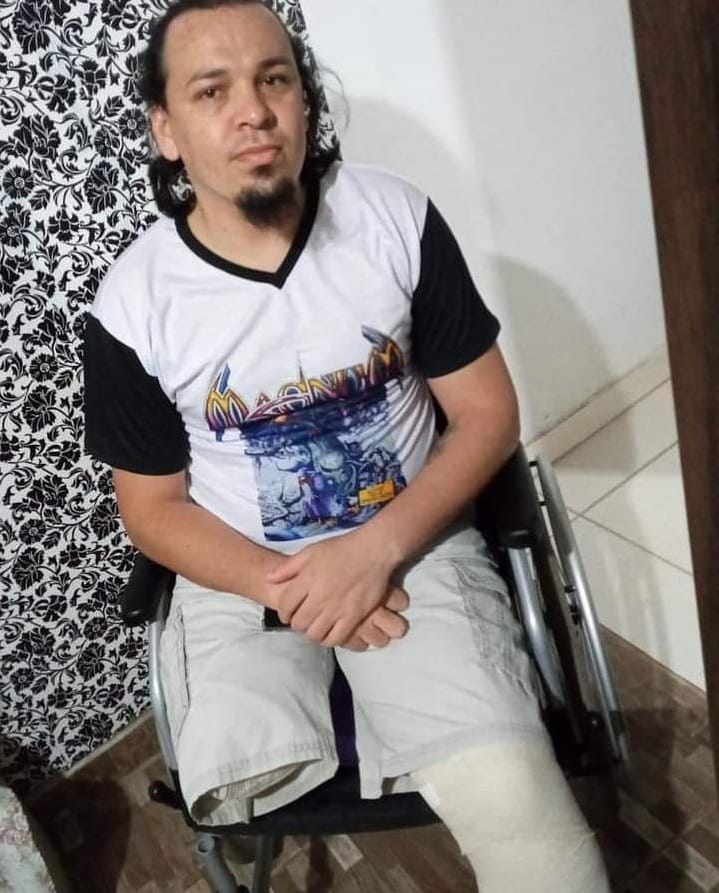machine_cast's tweet photo. Esse é nosso amigo e ouvinte Leandro Silva, que sofreu um acidente perdendo as duas pernas.
Vamos ajudar a viabilizar tratamento e próteses?

Link da Vakinha - https://t.co/E5rv7wjliv

PIX - tel.11995801160

Perfil do Insta - https://t.co/M6hrZRHW6W

AJUDAR É UM ATO DE AMOR! https://t.co/AJY0lY2yPB