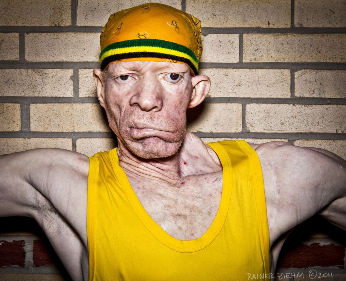 Yellowman. Yellowman певец. Yellowman регги. Винстон Фостер Yellowman.