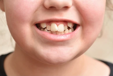 DentistryTfi's tweet photo. While #crookedteeth & a #misalignedbite can cause some #visual concerns for our #patients, these concerns can also potentially prompt a number of #dental #healthconditions. They can affect your overall #facialappearance, as well.
ORTHODONTICS at https://t.co/cq8HahCKoR https://t.co/OrxScfE6qd