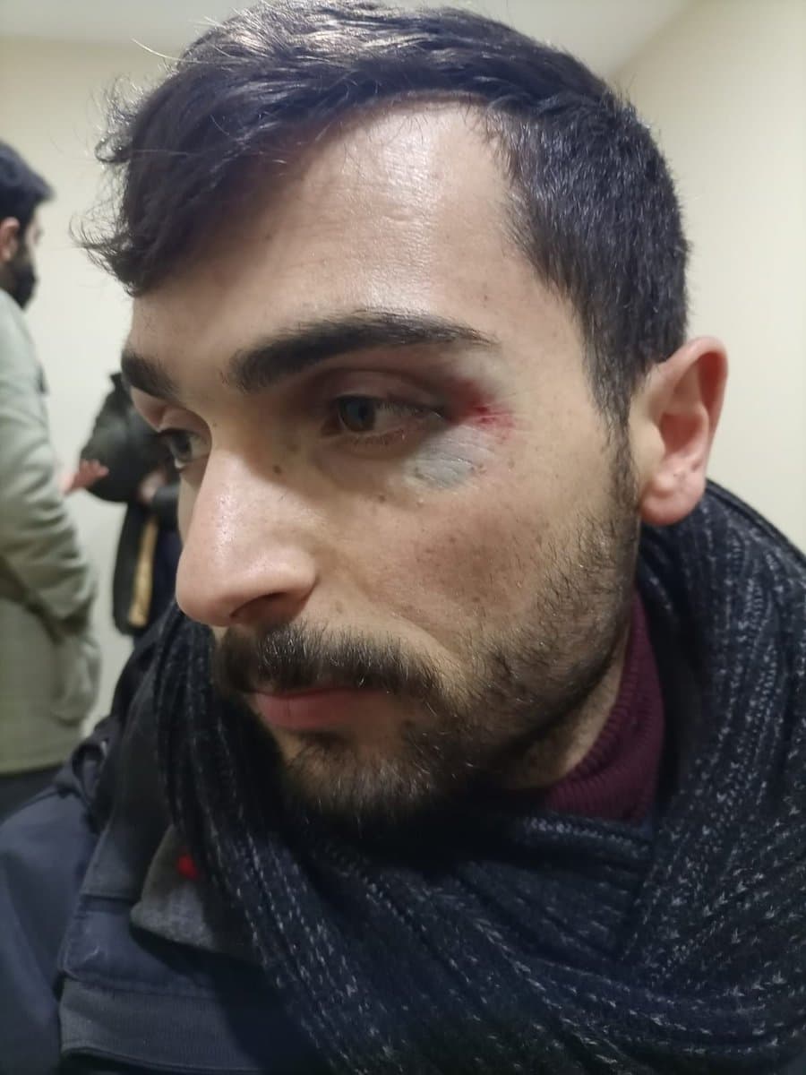 ogrncifaaliyeti's tweet photo. Gözaltına alınan arkadaşlarımızdan polis işkencesini belgeleyen fotoğraflar gelmeye devam ediyor. Geleceksizliğe karşı basın açıklaması gerçekleştirmek isteyen üniversitelilerin yüzlerinde morluklar, kafalarında dikişler var. 

Hesap yapmayacağız, hesaplaşacağız! https://t.co/fZV9JuByY4