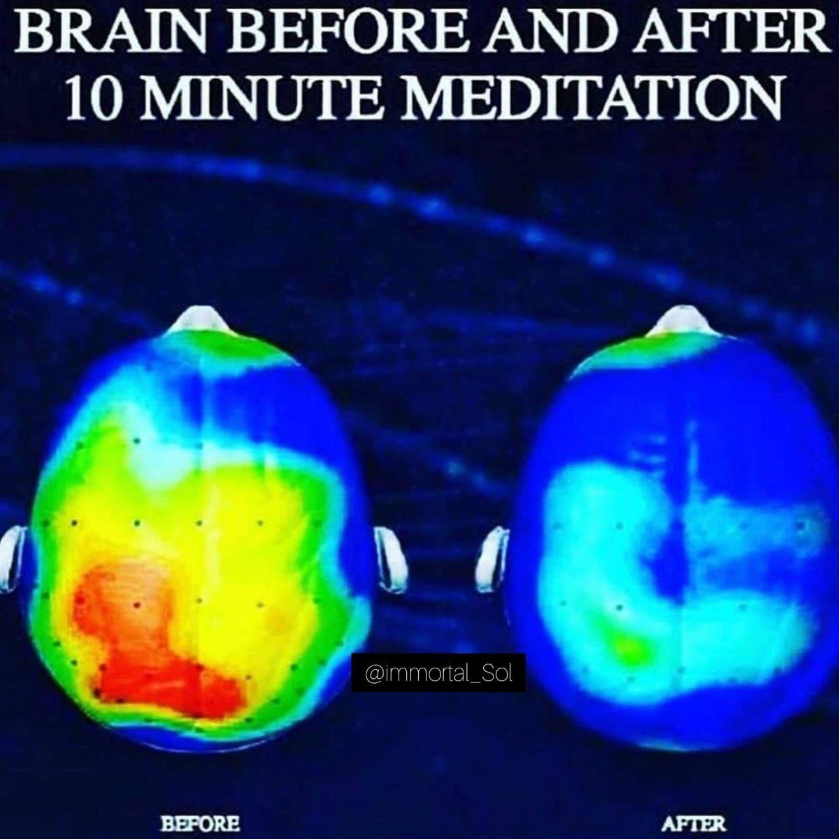 The Brain Before And After A 10 Minute Meditation