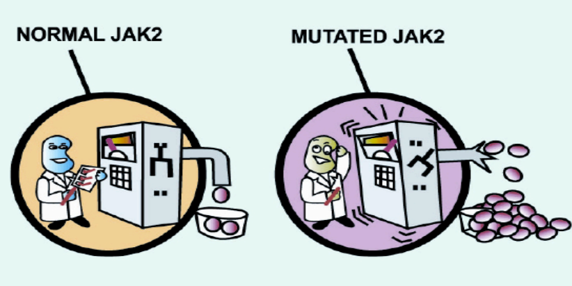 JAK2 mutation.. ( how I wish a cafeteria's snacks vending machine would behave 😏).. is regularly looked for when Myeloproliferative Neoplasms are suspected ( e.g., Polycythemia vera, Essential thrombocythemia, & Myelofibrosis/myeloid metaplasia ) /1 🧵
#hematology #hemepath