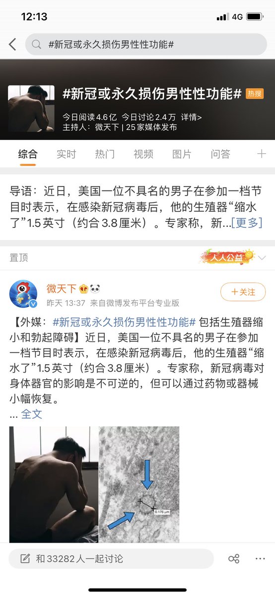 UZd5x's tweet photo. 3.8cm，这应该是按照勃起后算的吧，吓得我赶快量量小兄弟身高 https://t.co/7VF2lqB9HK
