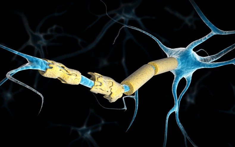 ingentium_ms's tweet image. Epstein-Barr Virus Found to Trigger Multiple Sclerosis dlvr.it/SH8sWC