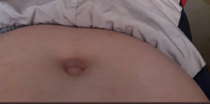 ERİTTİM  GÖBEĞİ.