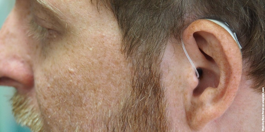 👂Hearing loss is a common factor underlying #tinnitus, although some people with normal hearing may also experience tinnitus. 

Find out more:
tinnitus.org.uk/hearing-aids-a…