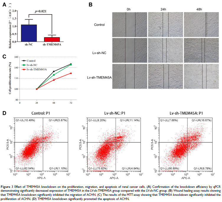 RBResearchTeam's tweet image. Transmembrane protein 45A (TMEM45A) was shown to be considerably overexpressed in patients with ccRCC and resulting in poor mortality, and linked to a variety of clinicopathological criteria such as histological grade.
Source: doi.org/10.2147/JIR.S3…
SHARED BY: Alif Haikal Elias