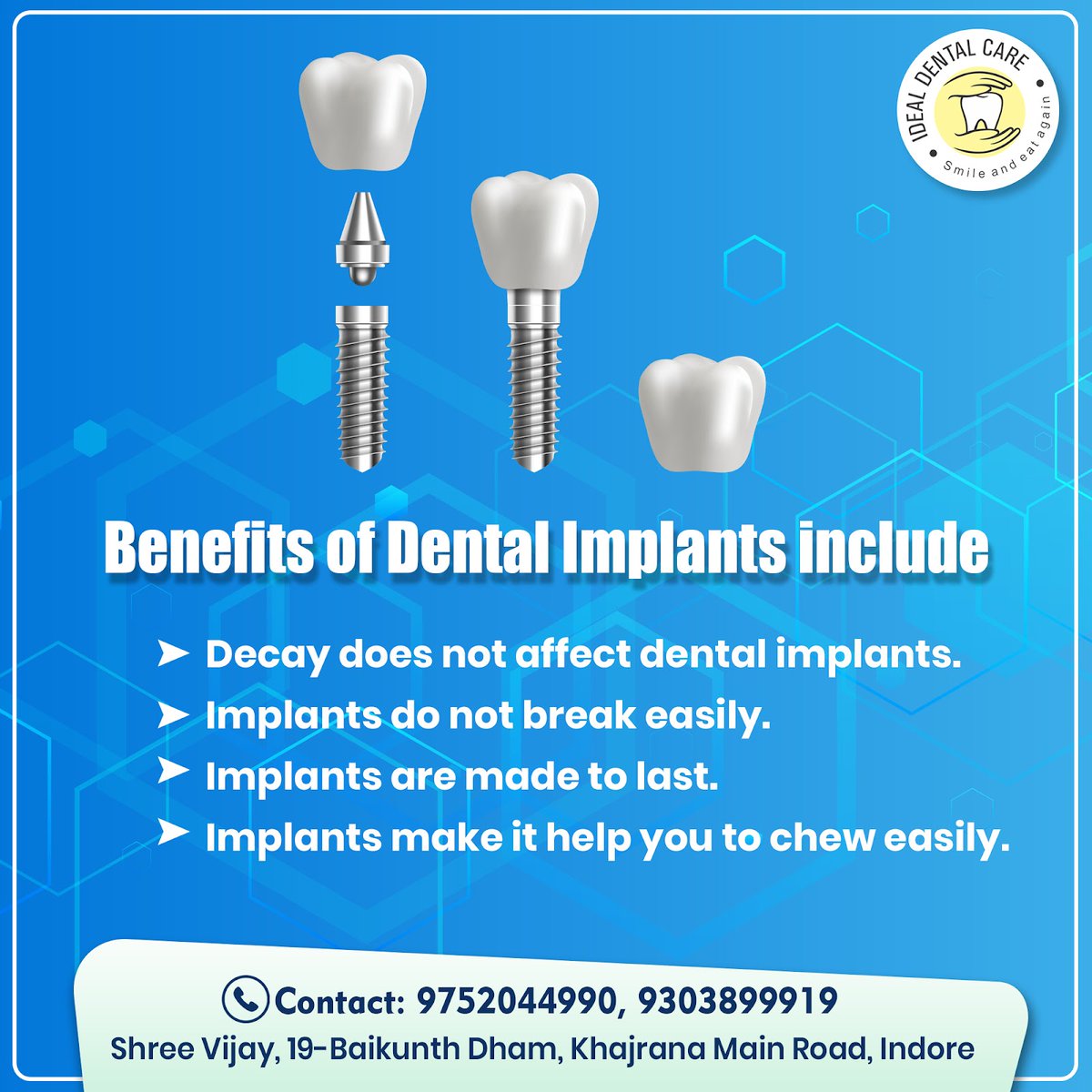 Dental Implant Treatment is the optimum dental care procedure to help you chew easily and has multiple benefits. 

Now, smile flawlessly with 100% painless dental implants from Ideal Dental Care. 

Book an appointment today!

https://t.co/LcRam0sCtb https://t.co/SDafCrOQ9B
