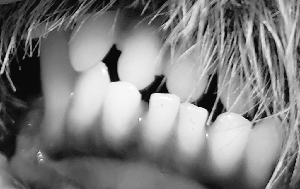 あんず 受け口矯正中 Ukeguchichan Twitter