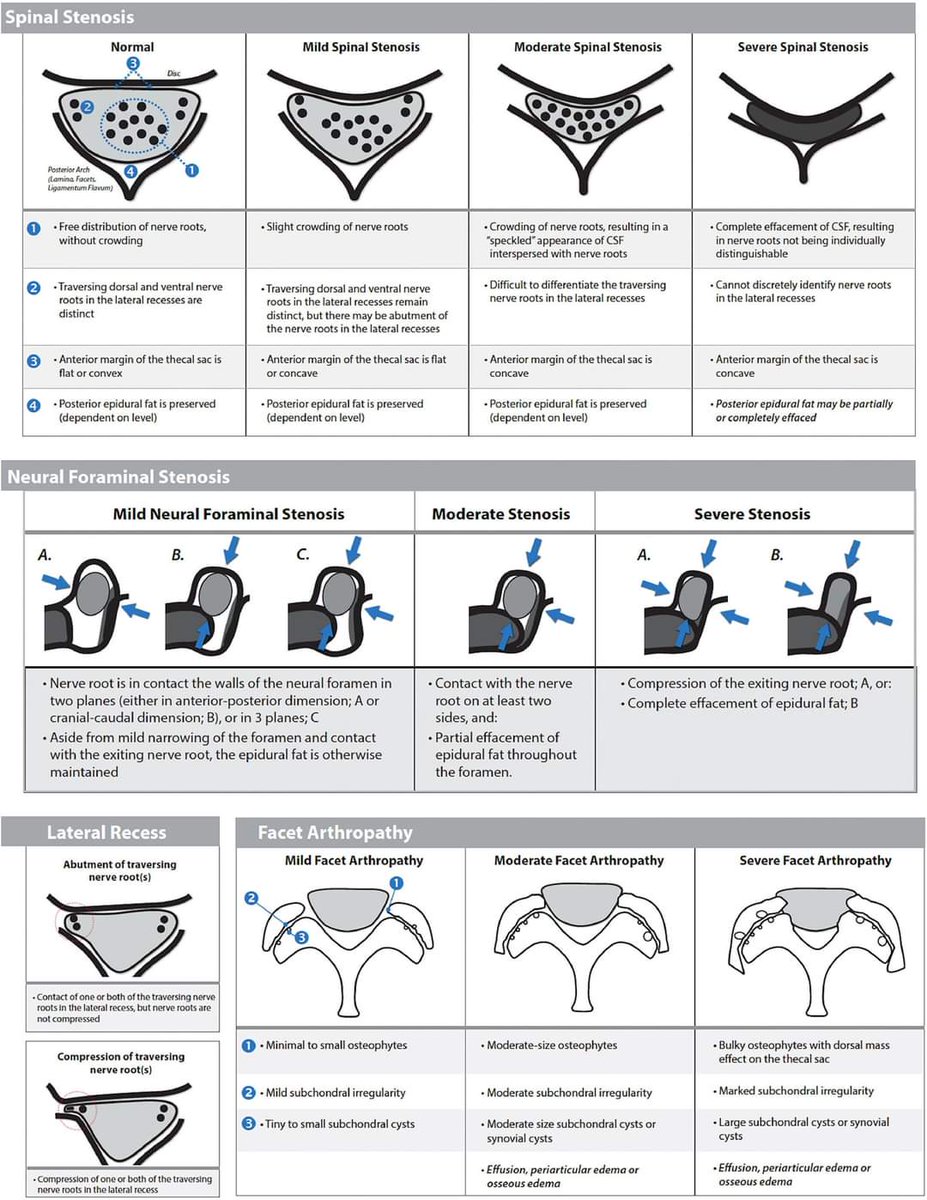 Neurosurgery Cocktail (@bipinchaurasia_) on Twitter photo 