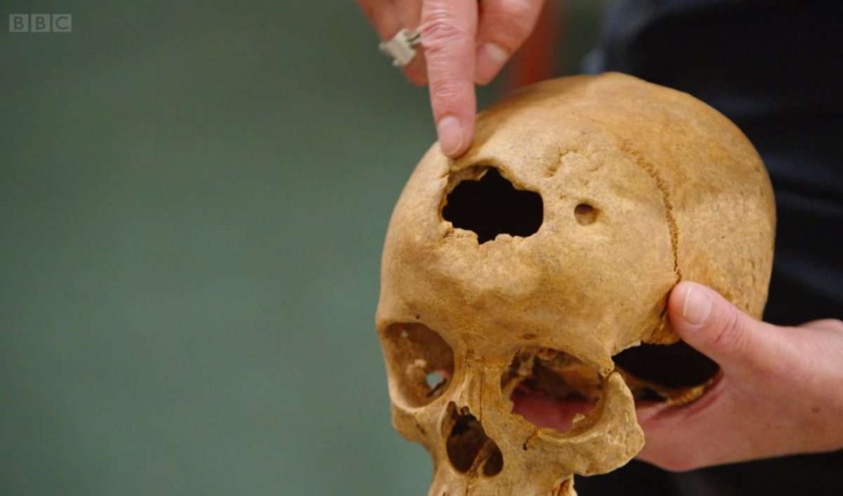 sotonarch's tweet photo. Did you see the facial reconstruction work by our past UG student Elysia Greenway in #DiggingForBritain earlier this week? She reconstructed the face of a woman before she experienced a violent facial injury.
Catch up on  https://t.co/yPJpn9OmFq https://t.co/xBWwn9n3vJ