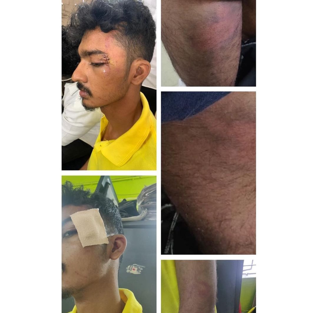 malya_6232's tweet photo. It began with Bennicks and Jayaraj.
Till now the government has taken no steps to tackle the endemic problem of police brutality.
#justiceforabdul #stoppolicebrutality https://t.co/brLmg8isR1