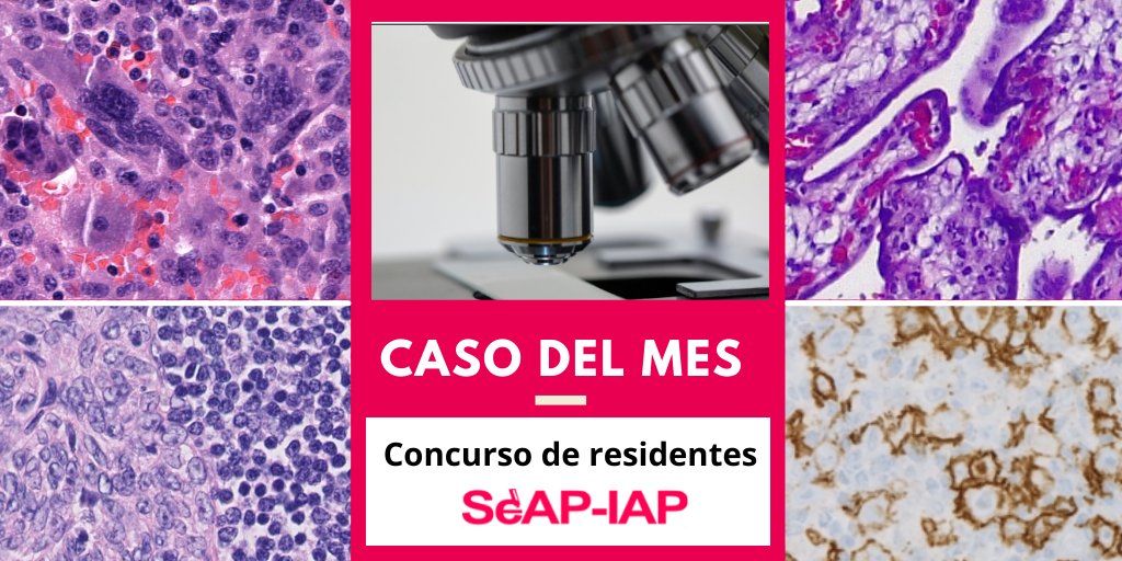 SEAP-IAP tweet media