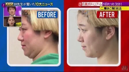 @Pr1kHIAOviGmLri 誤：BEFORE　AFTER
正：顎を引く　顎を引かない 