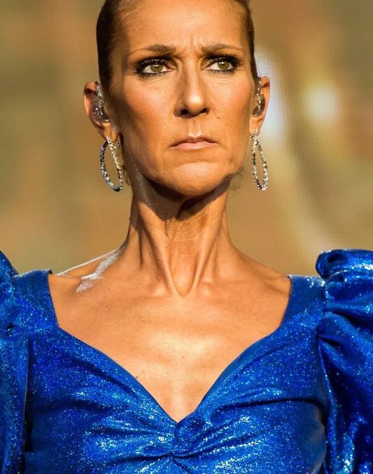 Celine Dion cancels remaining tour dates due to ‘persistent’ medical issues…