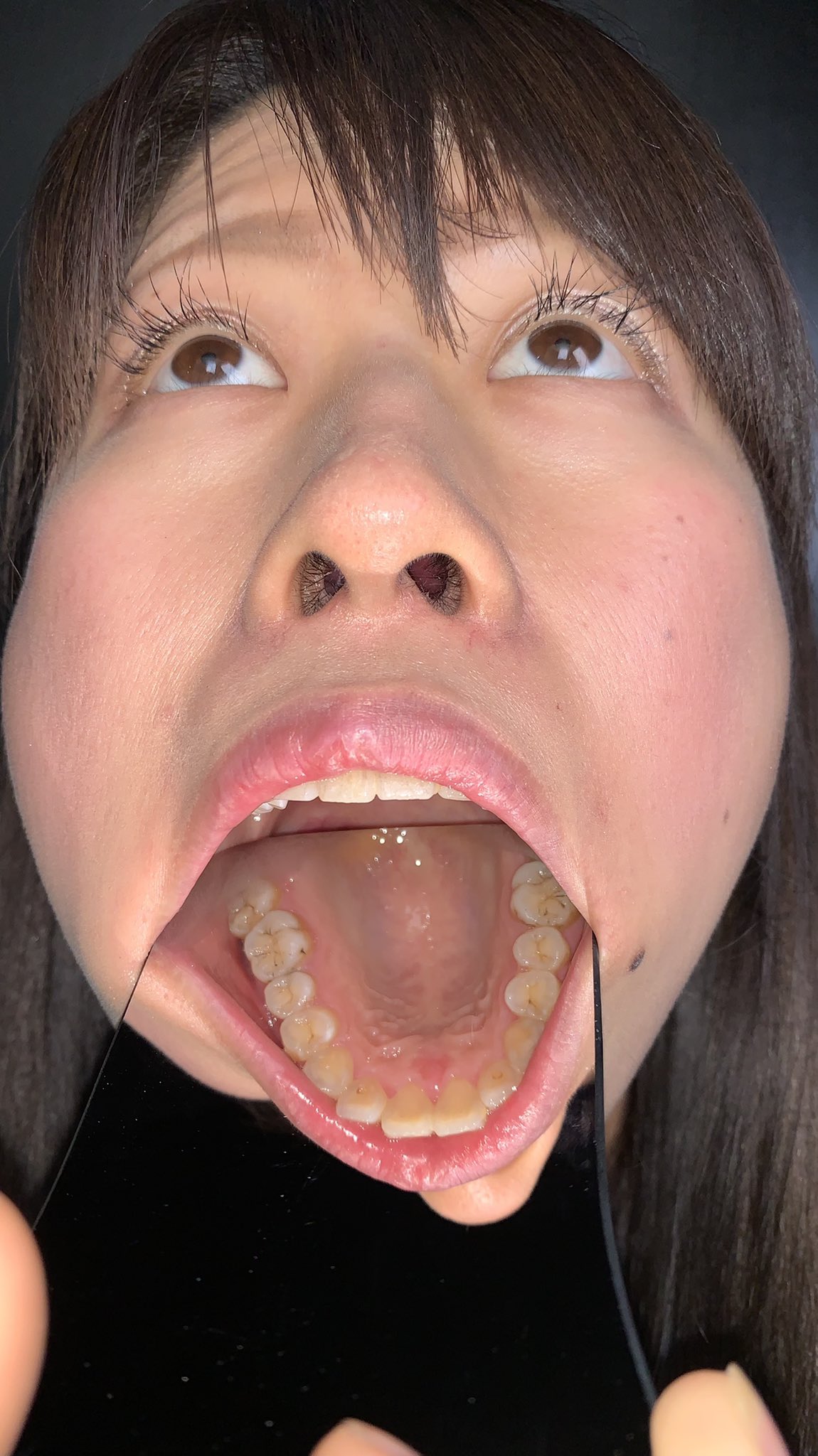 熟女銀歯画像  / X